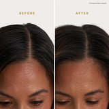 Signature Dry Shampoo Scalp Therapy