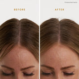 Signature Dry Shampoo Scalp Therapy